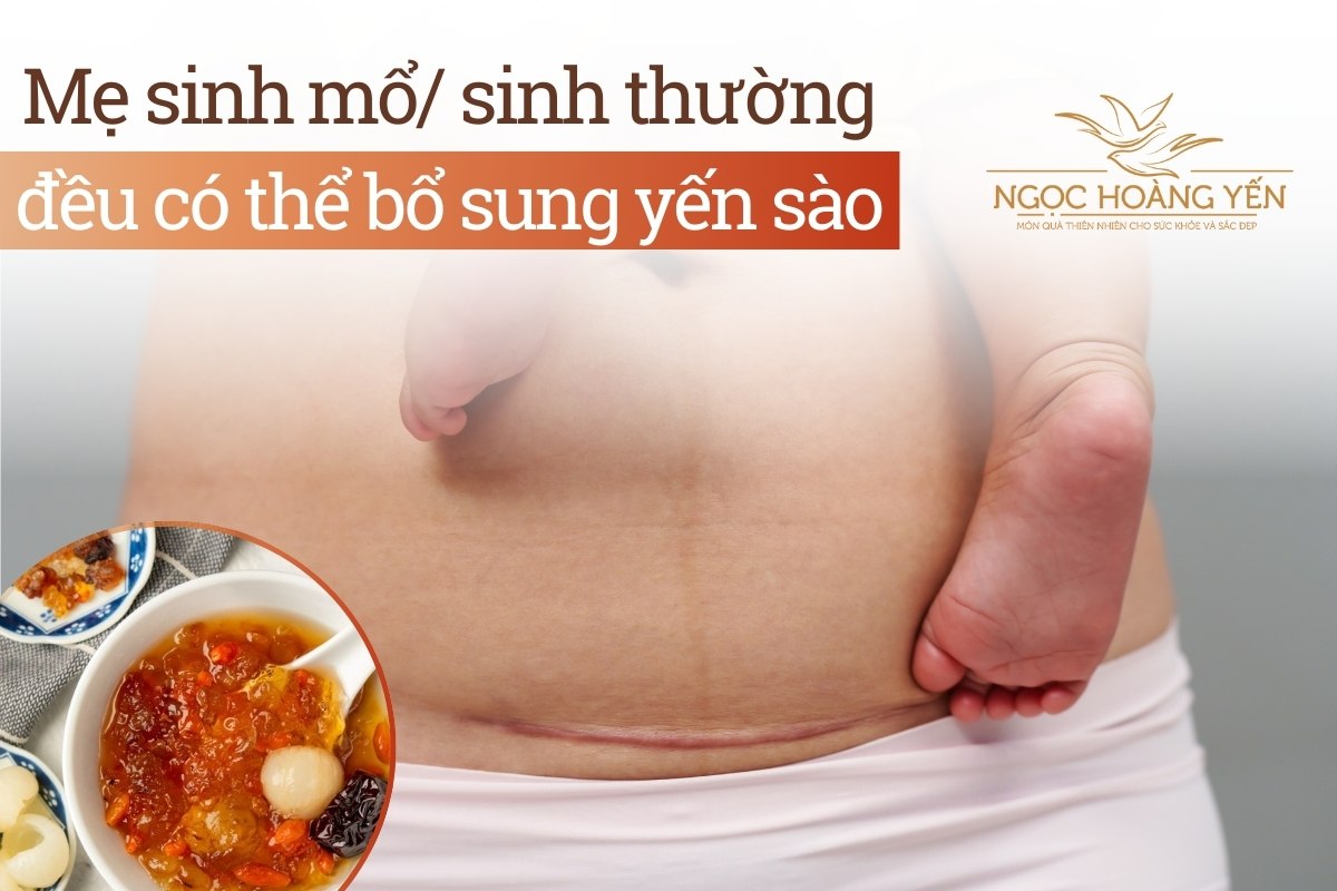 Mẹ sinh mổ/ sinh thường đều có thể bổ sung yến sào