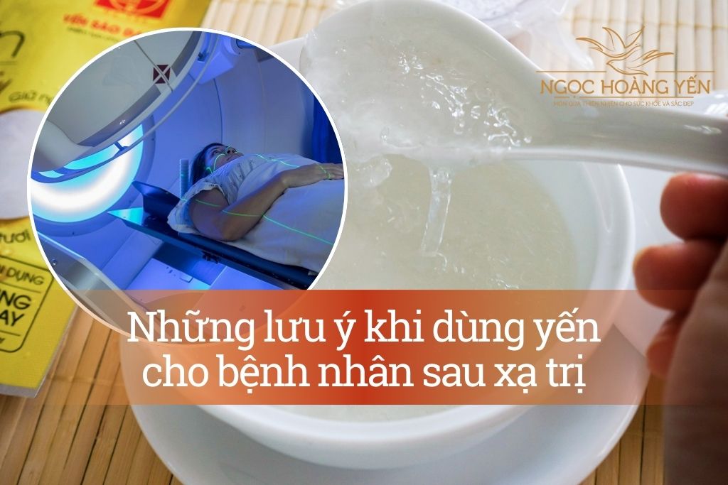 Những lưu ý khi dùng yến cho bệnh nhân sau xạ trị