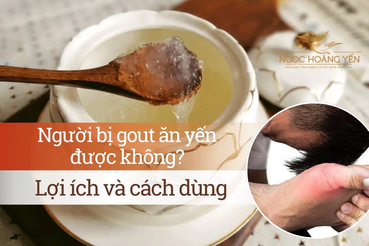 Người bị gout ăn yến được không? Lợi ích và cách dùng