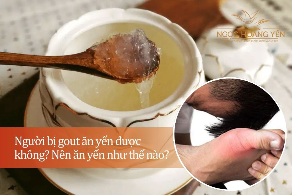 Người bị gout ăn yến được không? Nên ăn yến như thế nào?