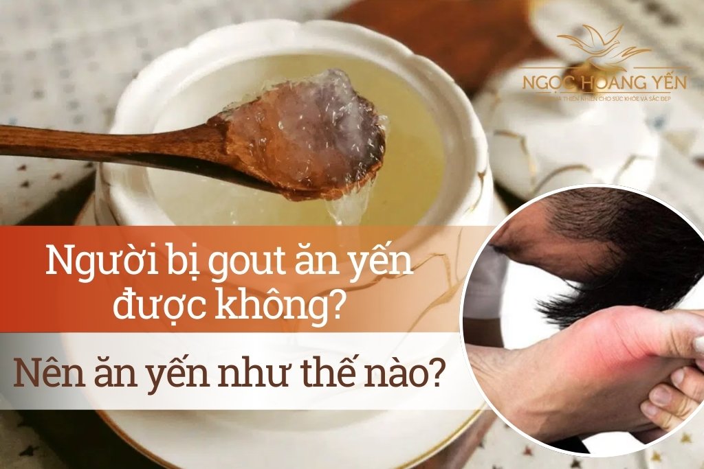 Người bị gout ăn yến được không? Nên ăn yến như thế nào?