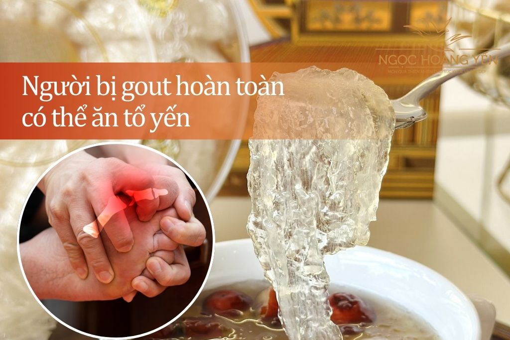 Người bị gout hoàn toàn có thể ăn tổ yến