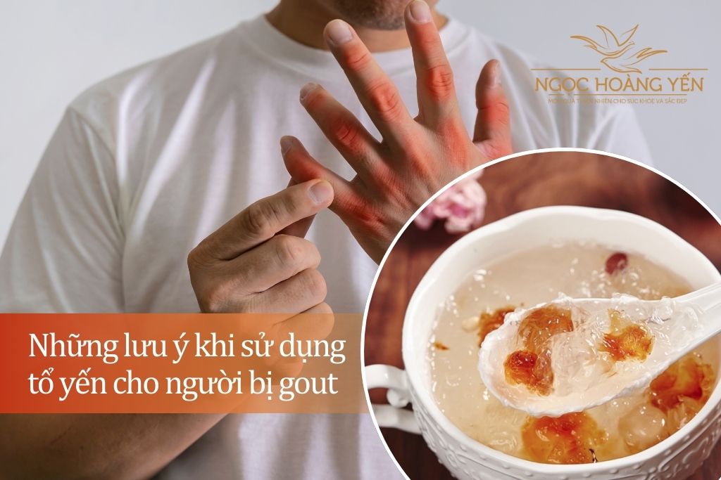 Những lưu ý khi sử dụng tổ yến cho người bị gout