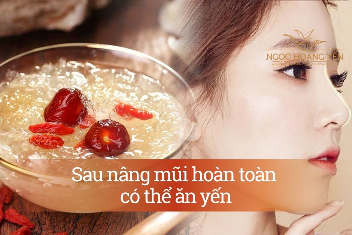 Sau nâng mũi hoàn toàn có thể ăn yến