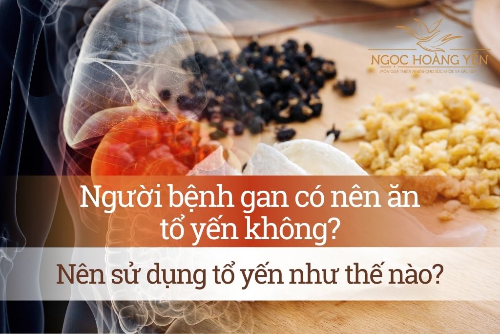 Người bệnh gan có nên ăn tổ yến không? Nên sử dụng tổ yến như thế nào?