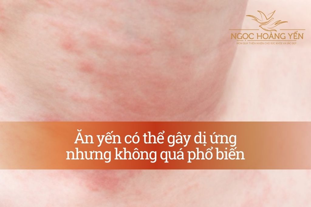Ăn yến có thể gây dị ứng nhưng không quá phổ biến