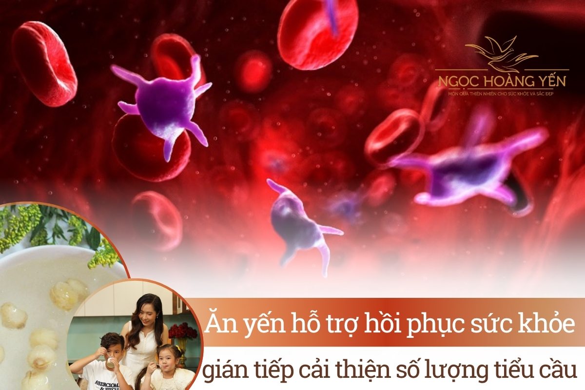 Ăn yến hỗ trợ hồi phục sức khỏe, gián tiếp cải thiện số lượng tiểu cầu