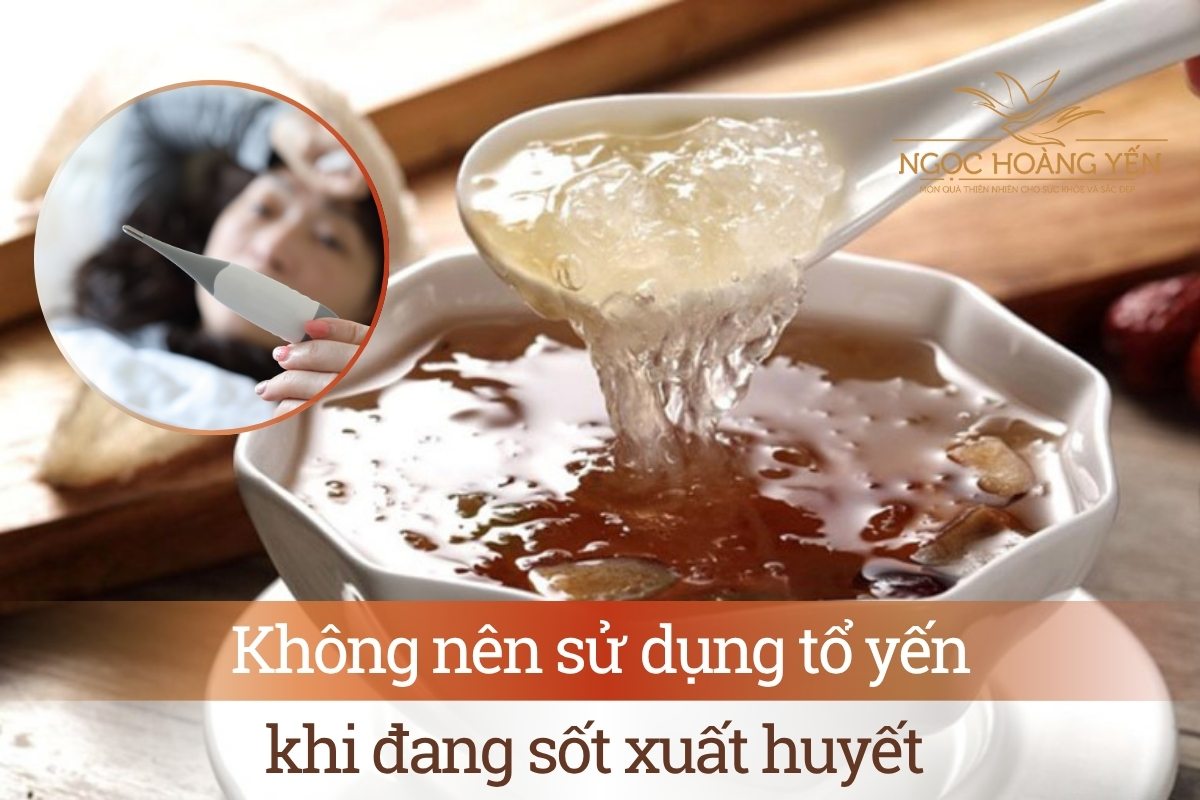 Không nên sử dụng tổ yến khi đang sốt xuất huyết