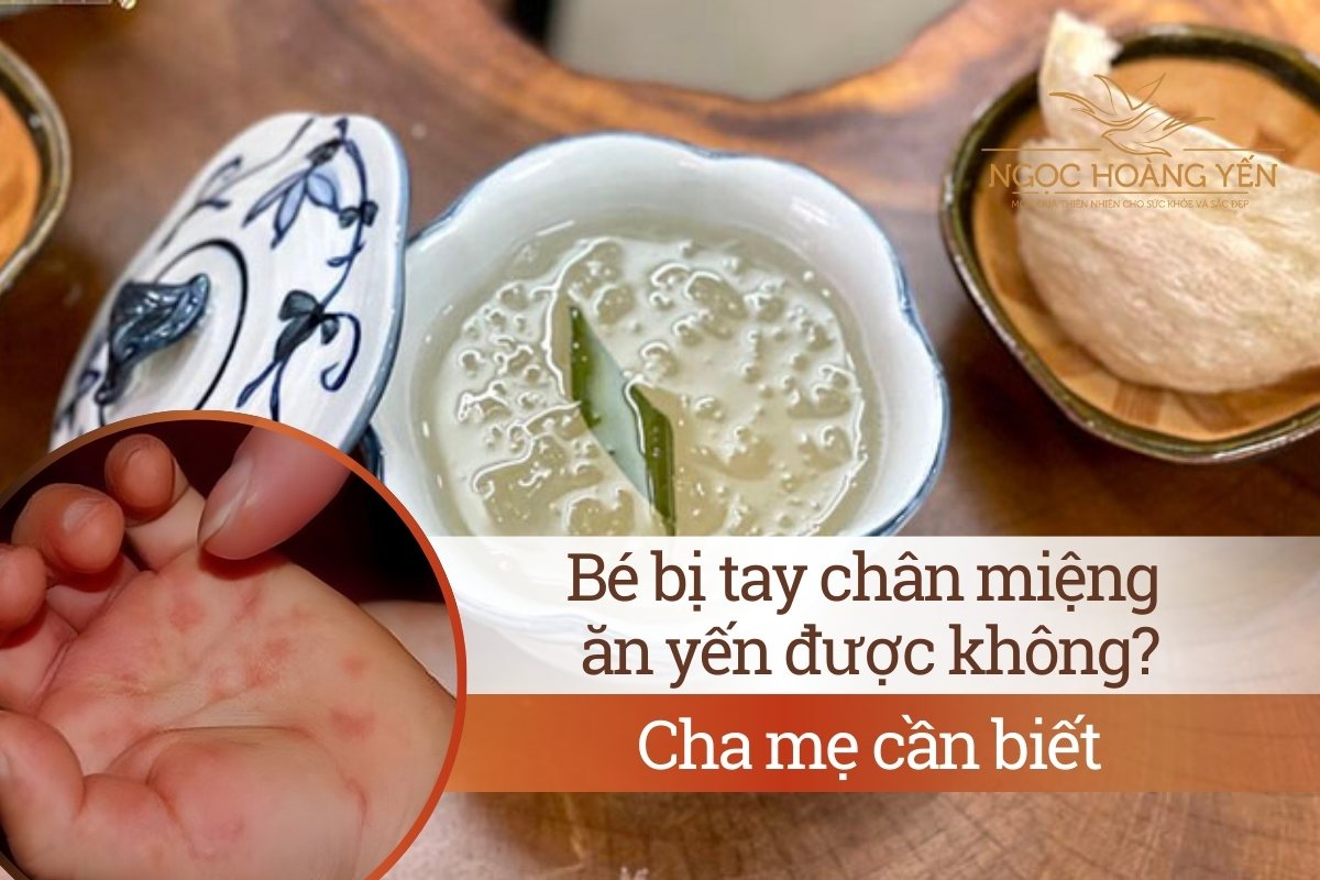 Bé bị tay chân miệng ăn yến được không? Cha mẹ cần biết