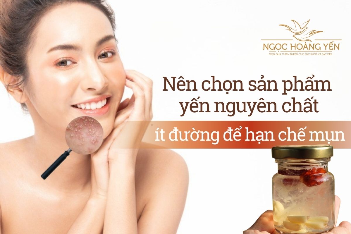 Nên chọn sản phẩm yến nguyên chất, ít đường để hạn chế mụn
