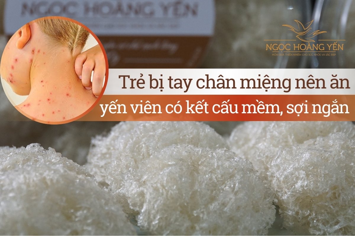 Trẻ bị tay chân miệng nên ăn yến viên có kết cấu mềm, sợi ngắn