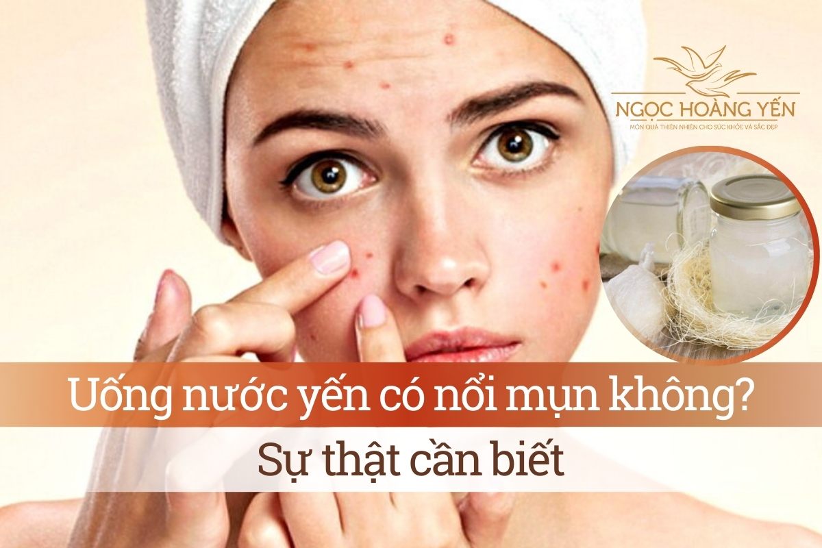 Uống nước yến có nổi mụn không? Sự thật cần biết