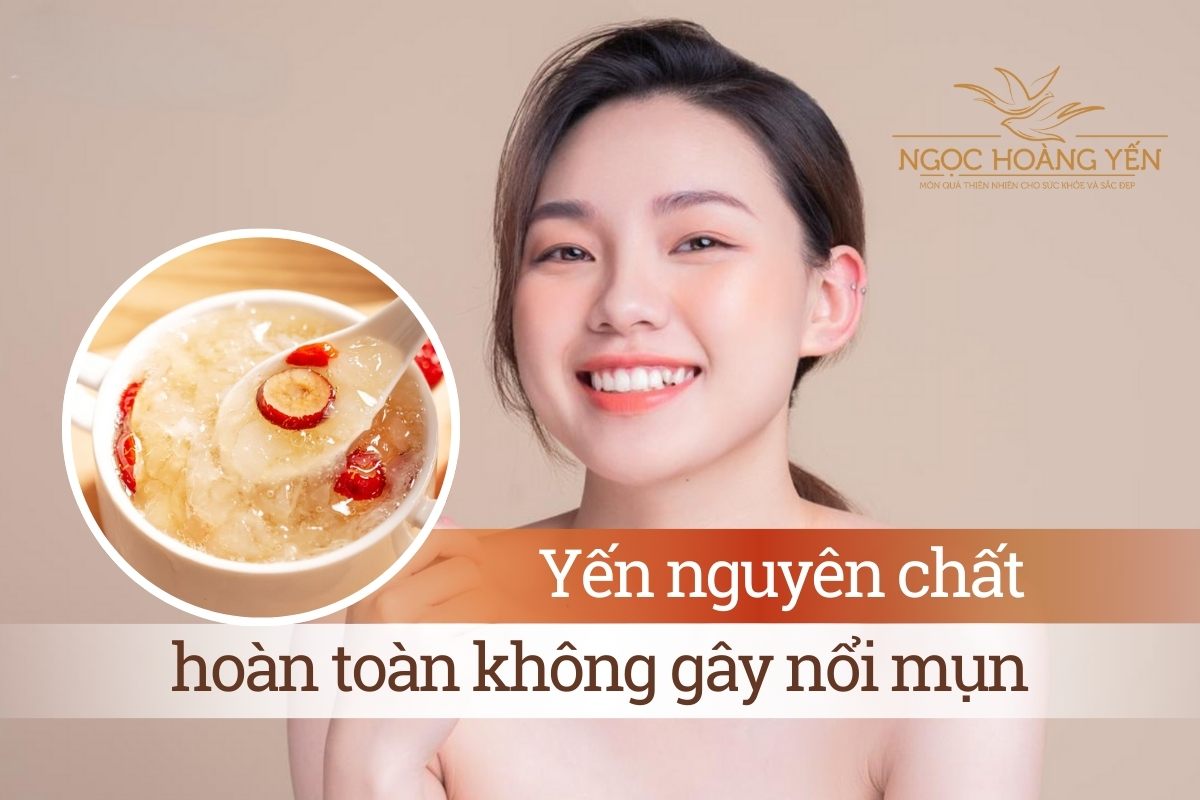 Yến nguyên chất hoàn toàn không gây nổi mụn